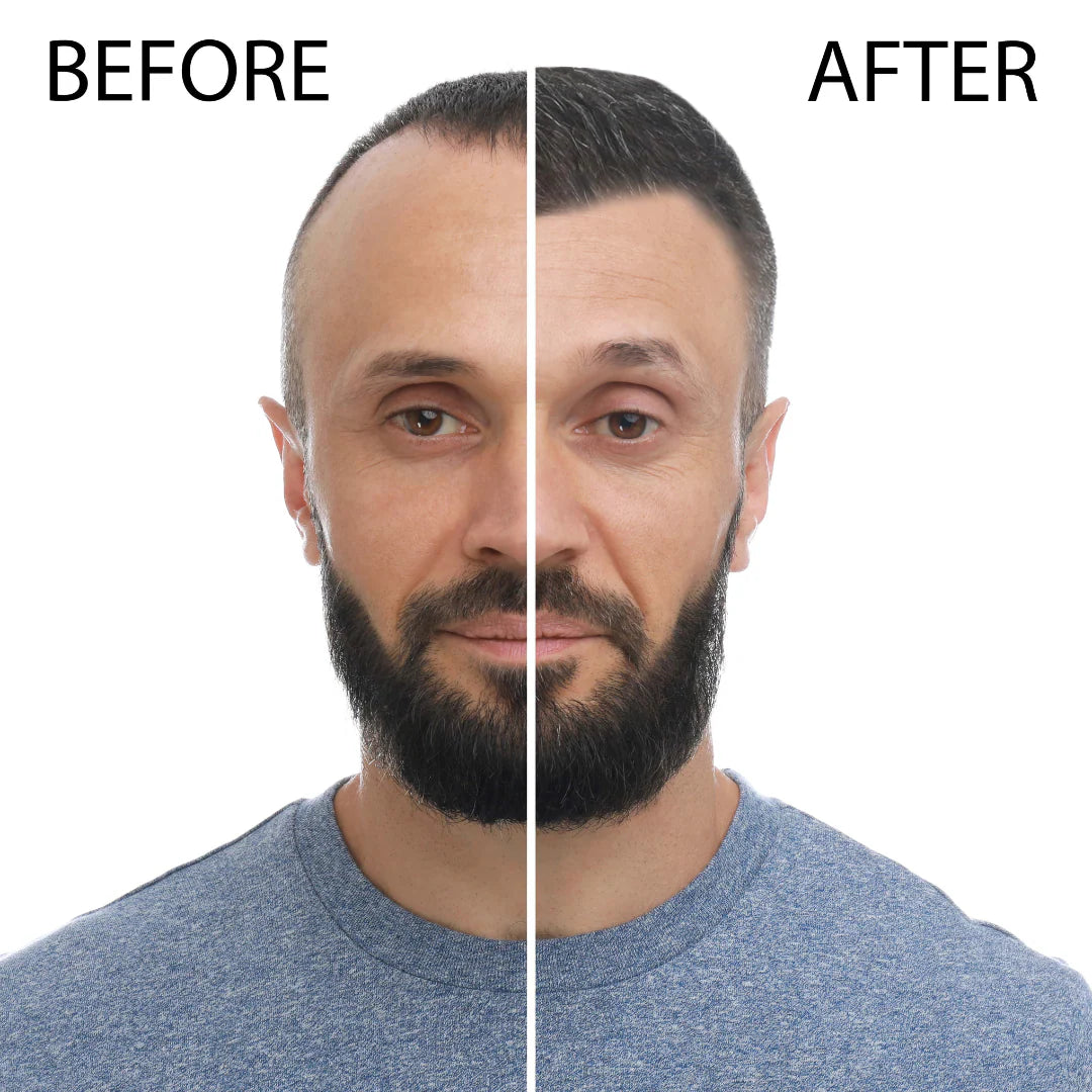 Zentria GrowthX Viral Hair ReGrowth System